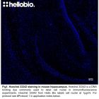 Fig1. Hoechst 33342 staining in mouse hippocampus.