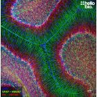 Figure 1. GFAP and Neurofilament L staining in rat cerebellum. Mounted using MightyMount<sup>TM</sup> Antifade Fluorescence Mounting Medium with DAPI (aqueous).