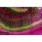 Figure 1. Parvalbumin and Neurofilament L staining in rat hippocampus. Mounted using MightyMount<sup>TM</sup> Antifade Fluorescence Mounting Medium with Propidium Iodide (aqueous).