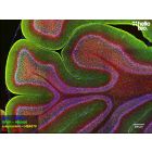 Figure 1. GFAP, alpha-synuclein and Neurofilament light staining in rat cerebellum. Mounted using MightyMount<sup>TM</sup> Antifade Fluorescence Mounting Medium (hardset).