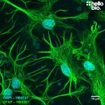 Figure 1. GFAP expression in a rat cultured neurone preparation visualised using HB8267.