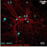 Rhodamine Phalloidin TRITC staining in cultured neurons